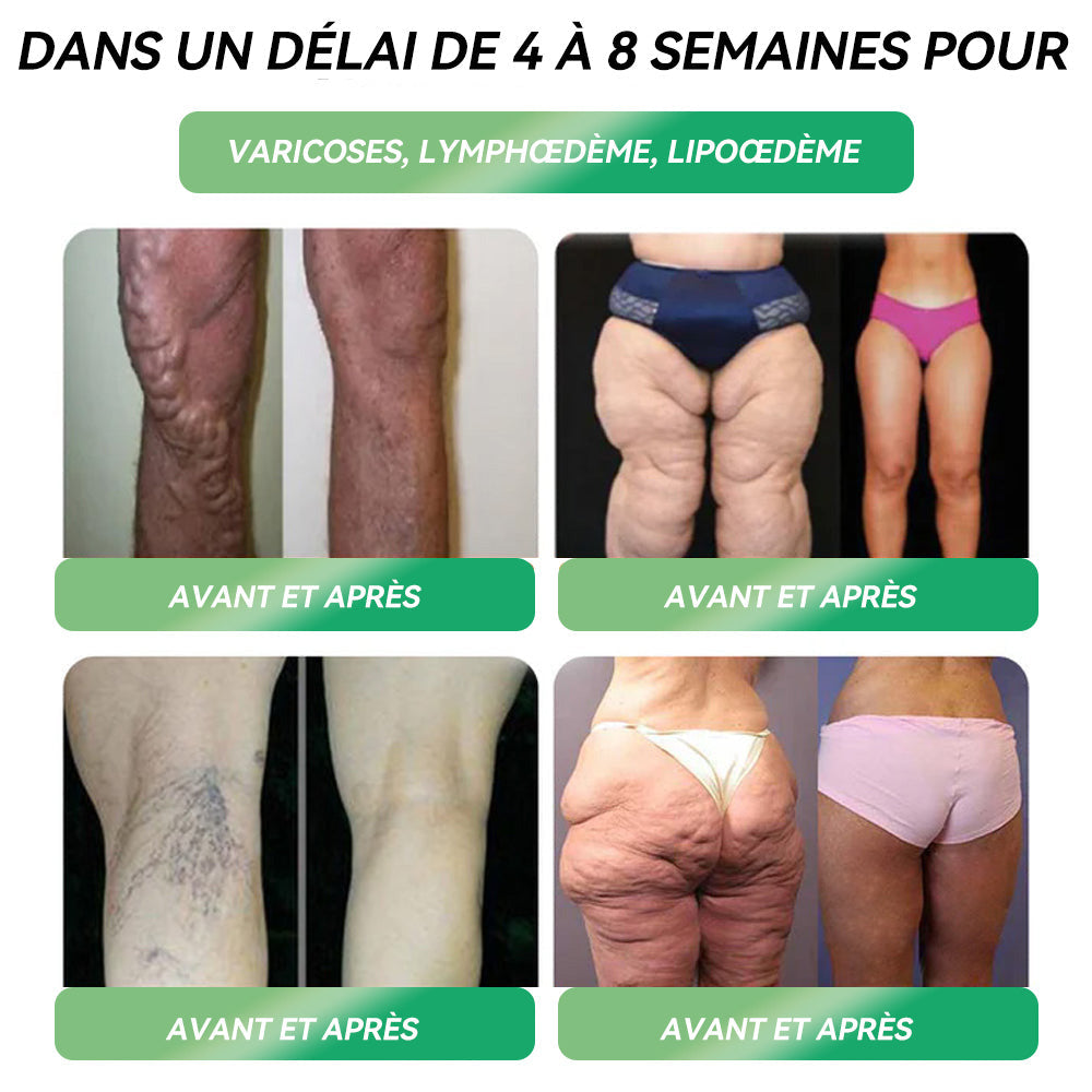 🛍️ Boutique Officielle | 𝑆𝑇𝐷𝐸𝐼®💕 Solution Orale 𝐺𝐿𝑃-1 pour la 𝑝𝑒𝑟𝑑𝑒 𝑑𝑒 𝑝𝑜𝑖𝑑𝑠 – 👨⚕️ Pour lutter contre l’𝑜𝑏𝑒́𝑠𝑖𝑡𝑒́, les maladies 𝑐𝑎𝑟𝑑𝑖𝑜𝑣𝑎𝑠𝑐𝑢𝑙𝑎𝑖𝑟𝑒𝑠, le 𝑑𝑖𝑎𝑏𝑒̀𝑡𝑒, l’𝑎𝑝𝑛𝑒́𝑒 𝑑𝑢 𝑠𝑜𝑚𝑚𝑒𝑖𝑙, les 𝑝𝑟𝑜𝑏𝑙𝑒̀𝑚𝑒𝑠 𝑎𝑢𝑥 𝑎𝑟𝑡𝑖𝑐𝑢𝑙𝑎𝑡𝑖𝑜𝑛𝑠 et bien plus encore
