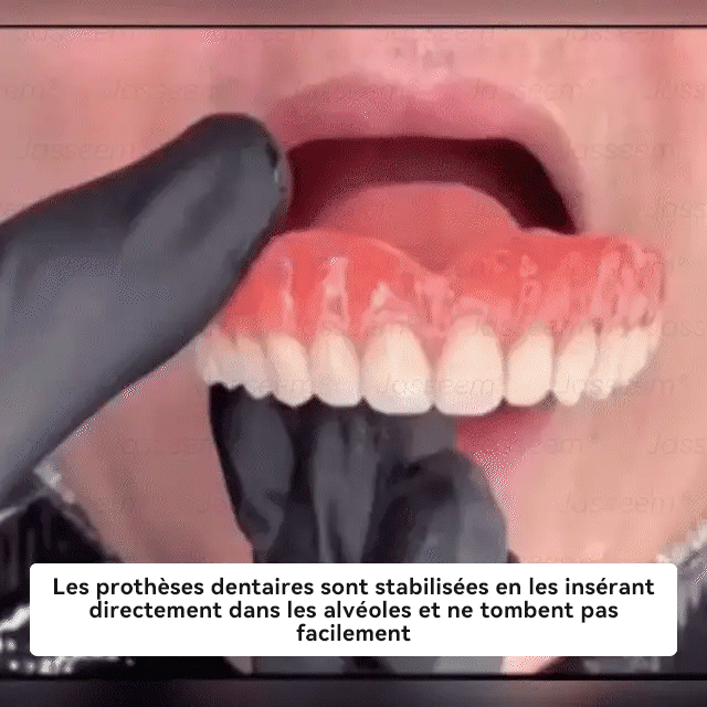 𝐉𝐚𝐬𝐬𝐞𝐞𝐦® Dernières Prothèses Dentaires Premium Confort🎁(Prothèses haut de gamme, Confortables à Porter - Remise de 70% pour une durée limitée)