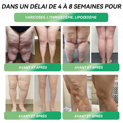 𝑉𝑠𝑜𝑥𝑎® 𝐺𝐿𝑃-1 𝑀𝑖𝑐𝑟𝑜𝑐𝑎𝑝𝑠𝑢𝑙𝑒 É𝑐𝑙𝑎𝑡𝑒𝑚𝑒𝑛𝑡 𝑃𝑎𝑡𝑐ℎ - 👨‍⚕️