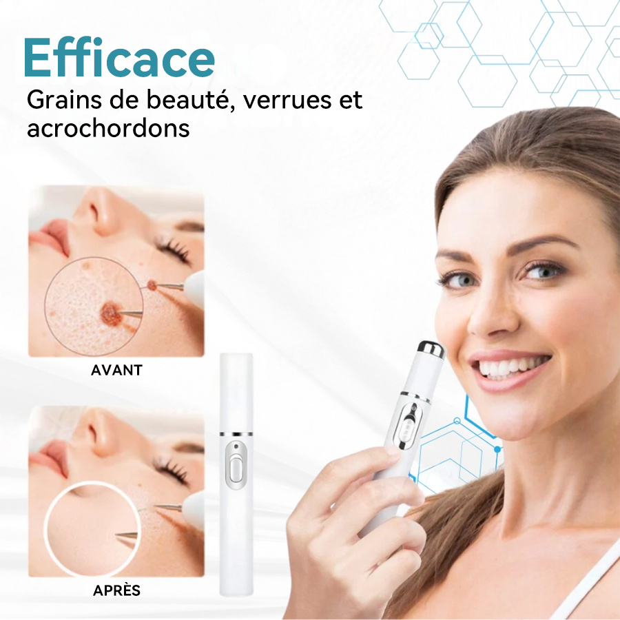 𝐉𝐚𝐬𝐬𝐞𝐞𝐦® Stylo Laser de Qualité Médicale 🎉 (utilise la technologie laser au CO₂ – efficace pour éliminer les grains de beauté, les verrues, les acrochordons, les taches pigmentaires et autres imperfections)🏆