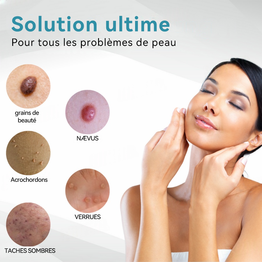 𝐉𝐚𝐬𝐬𝐞𝐞𝐦® Stylo Laser de Qualité Médicale 🎉 (utilise la technologie laser au CO₂ – efficace pour éliminer les grains de beauté, les verrues, les acrochordons, les taches pigmentaires et autres imperfections)🏆