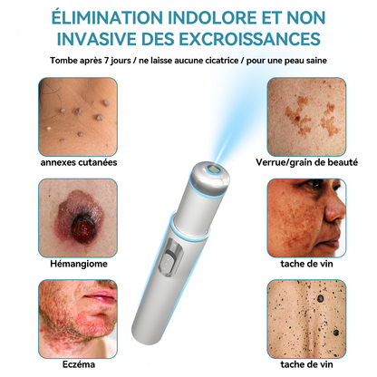 𝐉𝐚𝐬𝐬𝐞𝐞𝐦® Stylo Laser de Qualité Médicale 🎉 (utilise la technologie laser au CO₂ – efficace pour éliminer les grains de beauté, les verrues, les acrochordons, les taches pigmentaires et autres imperfections)🏆
