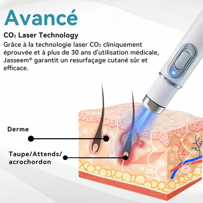 𝐉𝐚𝐬𝐬𝐞𝐞𝐦® Stylo Laser de Qualité Médicale 🎉 (utilise la technologie laser au CO₂ – efficace pour éliminer les grains de beauté, les verrues, les acrochordons, les taches pigmentaires et autres imperfections)🏆